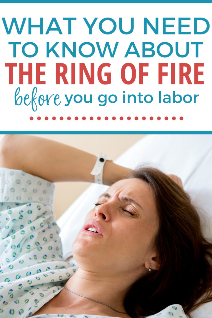 Ring of fire in pregnancy